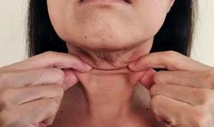 Como tratar a flacidez do rosto e pescoço com eficácia