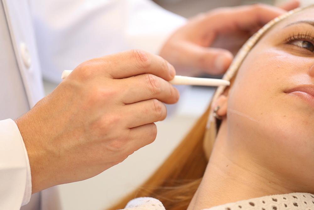 rejuvenescimento sem cirurgia