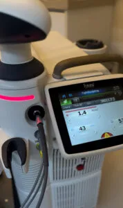 Equipamento de laser Fotona em sala de procedimentos, Cabral – Curitiba